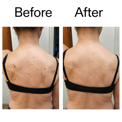RYVANE Smooth & Even Glycolic Body Stick