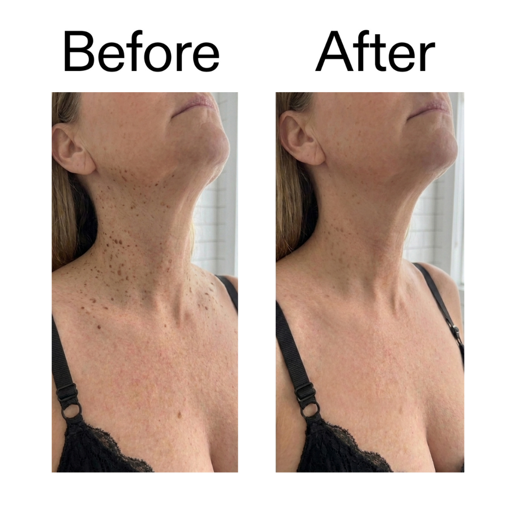 RYVANE Smooth & Even Glycolic Body Stick