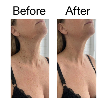 RYVANE Smooth & Even Glycolic Body Stick